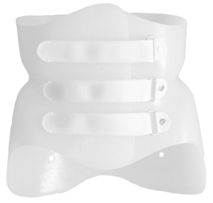 Corset de Boston - Scoliose correction, Corset polyéthylène (plastique  thermoformable)