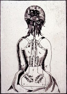corset de Venel - gravure